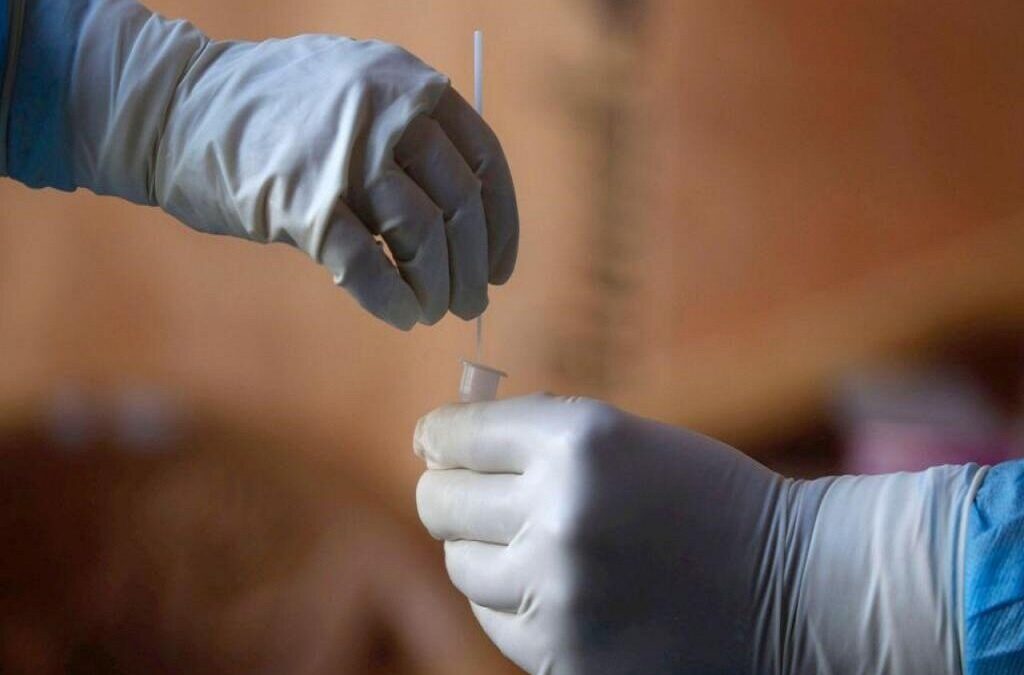 Mais de 22 milhões de testes realizados em Portugal desde o início da pandemia