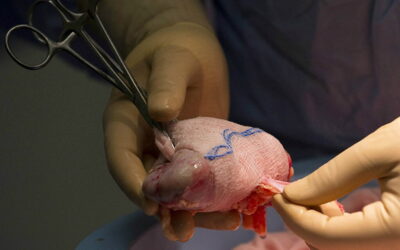 Quase dois mil doentes tiveram de aguardar por um transplante renal no final de 2020
