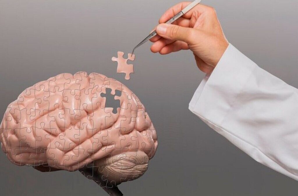 Novo medicamento para o tratamento de Alzheimer pode retardar a doença entre quatro a sete meses