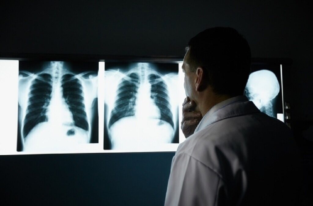 Mortes por cancro na laringe, traqueia, brônquios e pulmão subiram 50% em 20 anos
