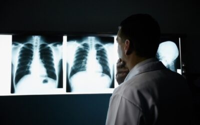 Associação RESPIRA reforça necessidade de vacinação contra doença pneumocócica invasiva