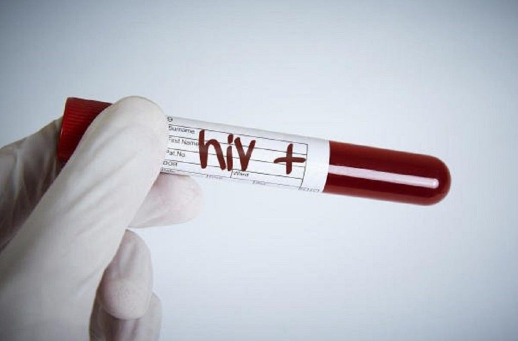 Centro Anti-Discriminação propõe que diploma pelo direito ao esquecimento abranga VIH