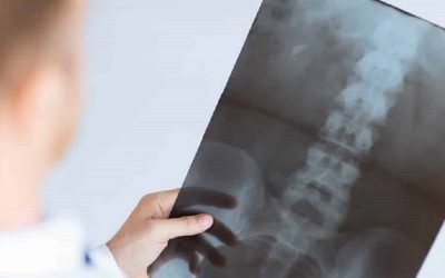Setor convencionado de radiologia custou cerca de 132 milhões de euros em 2023