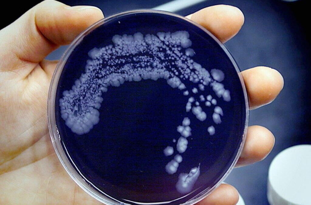 Bactéria da ‘legionella’ detetada em balneários de pavilhão em Redondo