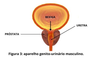 Hiperplasia Benigna da Próstata