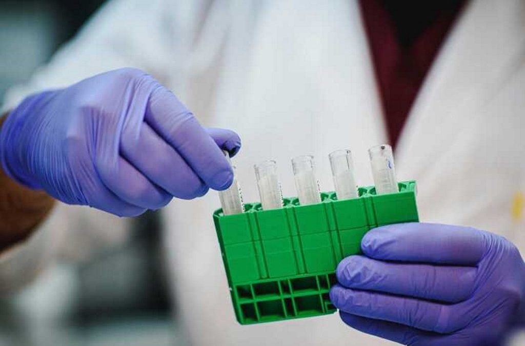 Investigadores australianos impedem ‘in vitro’ replicação da Covid-19 nas células humanas