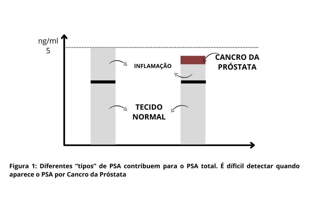 Cancro da Próstata (não metastático)