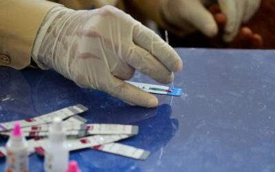 Covid-19: doentes com infeção VIH controlada têm melhor prognóstico