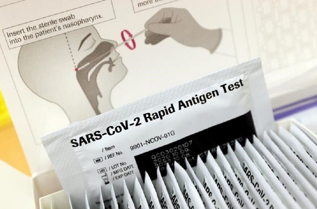 Três farmácias de Beja já disponibilizam testes de antigénio gratuitos