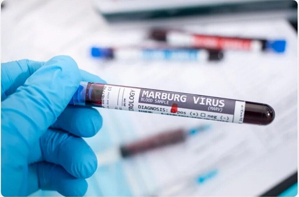 Fim da epidemia do vírus de Marburgo na Guiné Equatorial