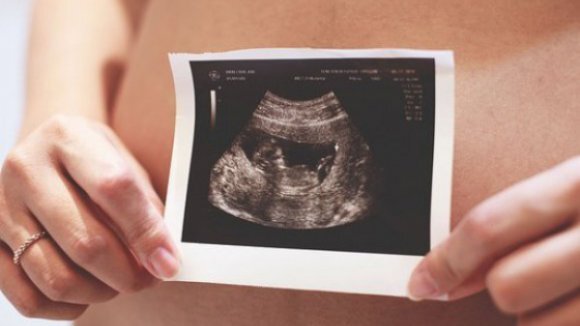 San Marino votou a favor da legalização do aborto