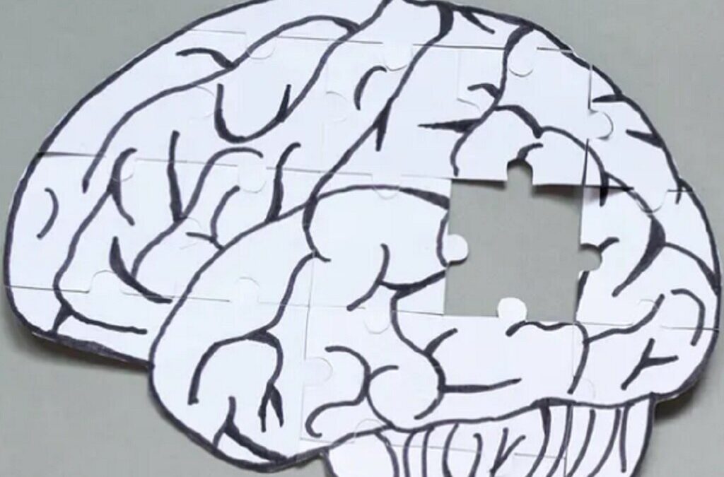Investigação liderada por português descobre que proteína cerebral atrasa “origem” de Alzheimer