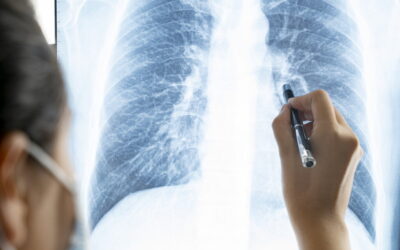 Pandemia fez disparar peso económico das doenças respiratórias para mais de 37 mil milhões de euros