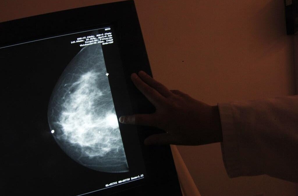 Bruxelas quer deteção precoce do cancro na UE e fim das desigualdades no tratamento