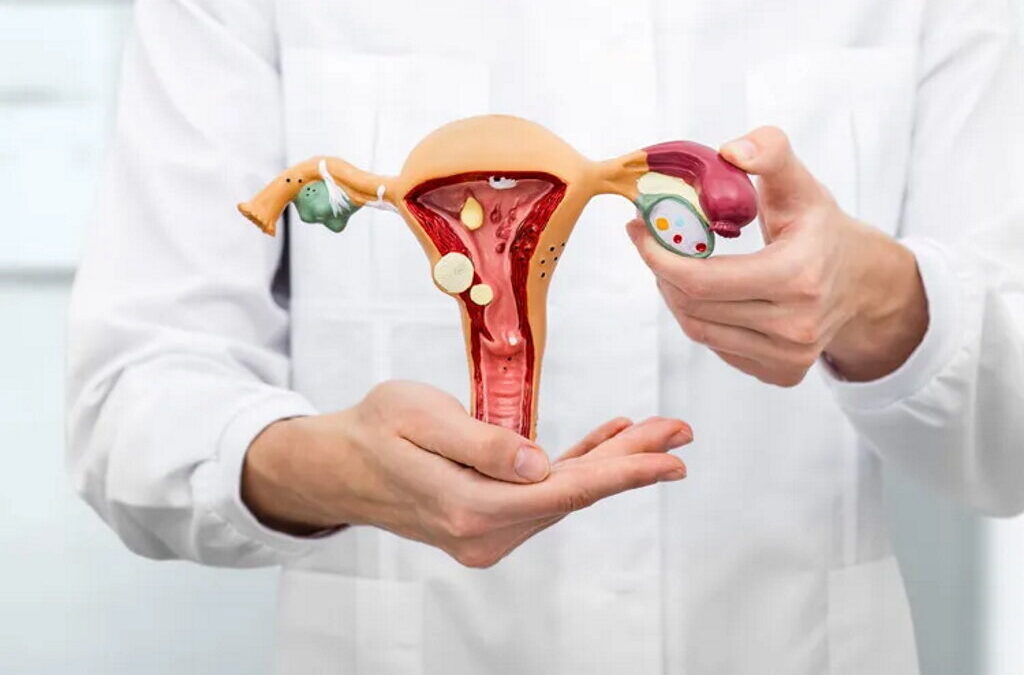 Estudo conclui que desvalorização dos sintomas leva a diagnóstico tardio da endometriose