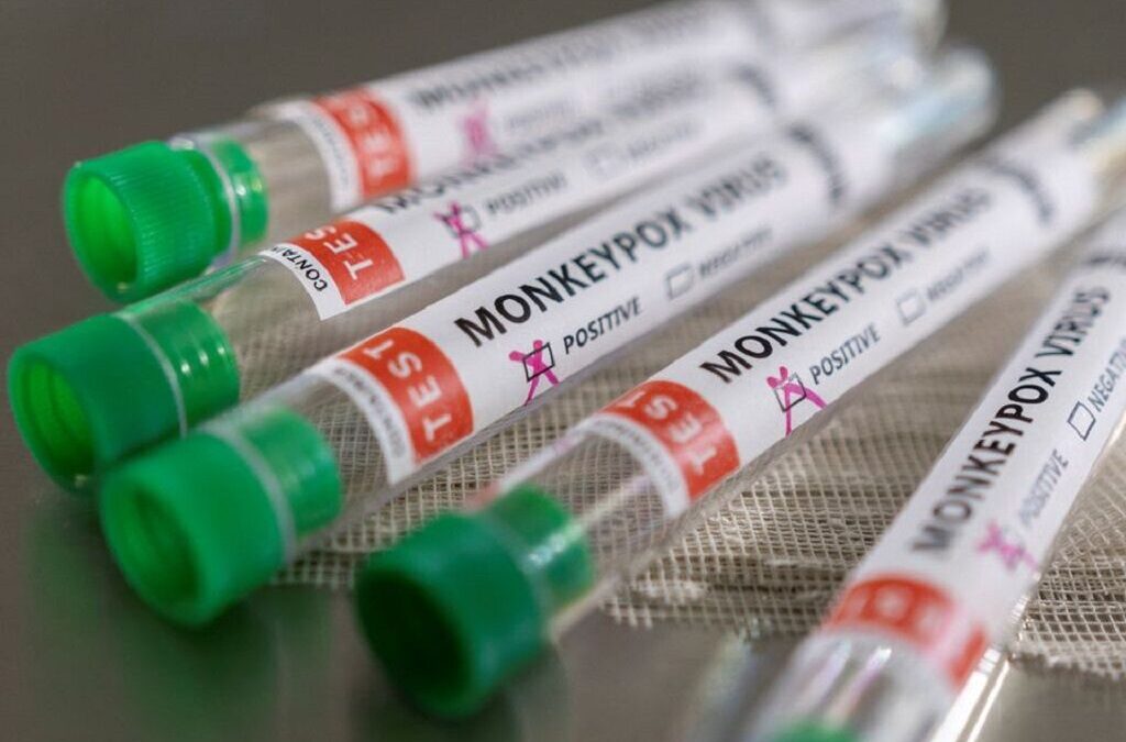 Singapura deteta primeiro caso de infeção por vírus Monkeypox