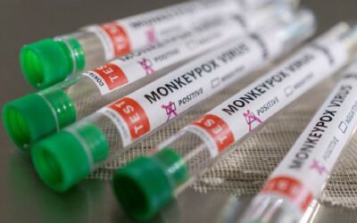 Monkeypox: 96 casos confirmados em Portugal