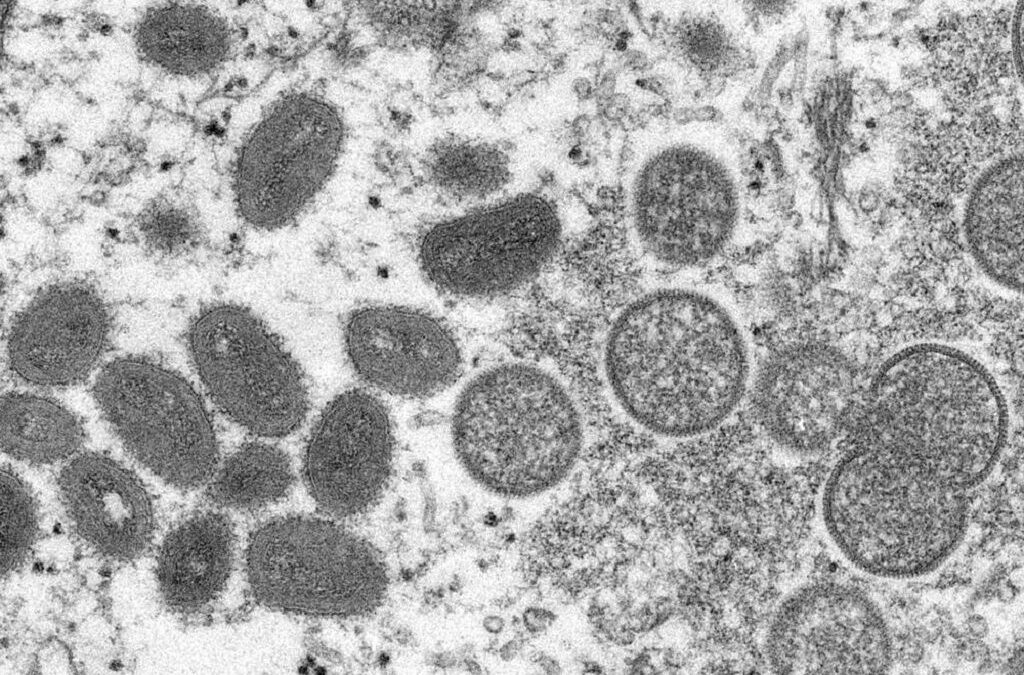 DGS admite vacina contra a varíola para conter cadeias de transmissão
