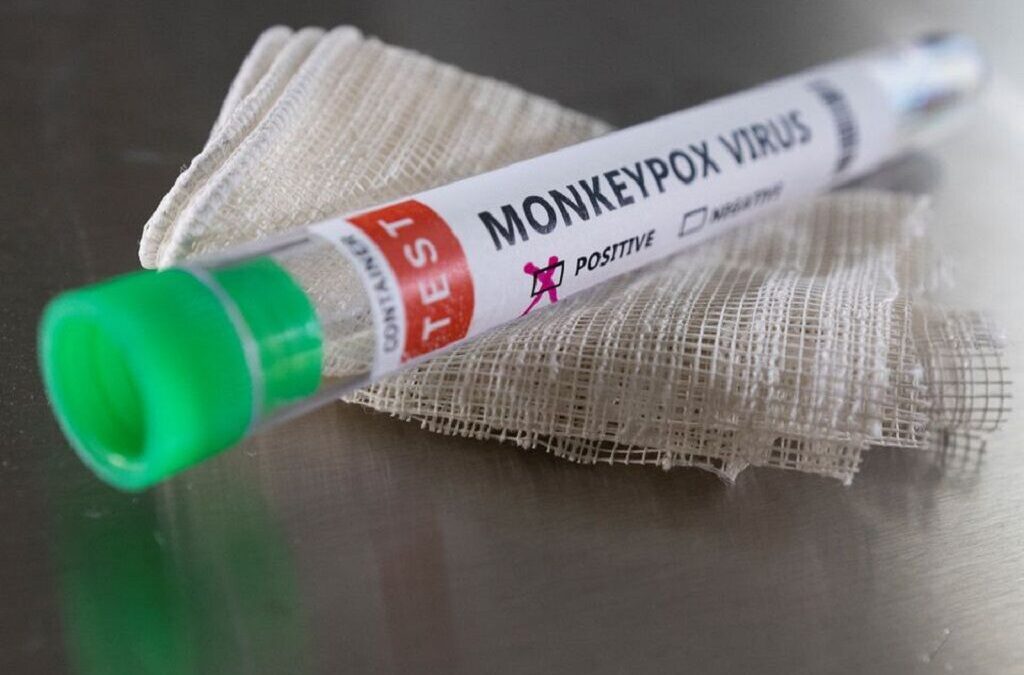 Portugal ultrapassa hoje os 300 casos de Monkeypox