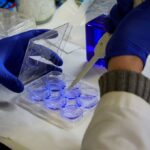 Centro europeu recomenda rastreio para Monkeypox quando já existem 85 casos na UE