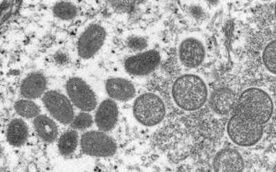 Mpox: Mais de 18.700 casos suspeitos ou confirmados em África desde início do ano