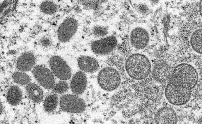Comissão Europeia vai adquirir mais de 100 mil medicamentos para varíola