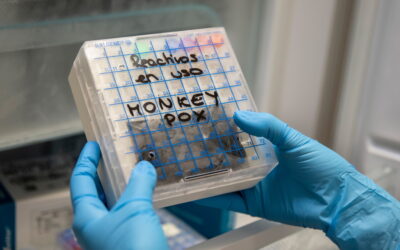 Portugal contabiliza 191 casos confirmados de Monkeypox