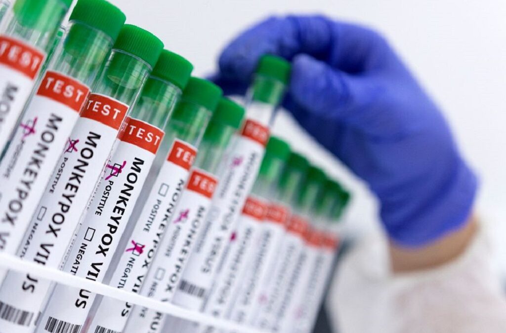 Monkeypox: OMS assinala 780 casos em 27 países não endémicos, incluindo Portugal