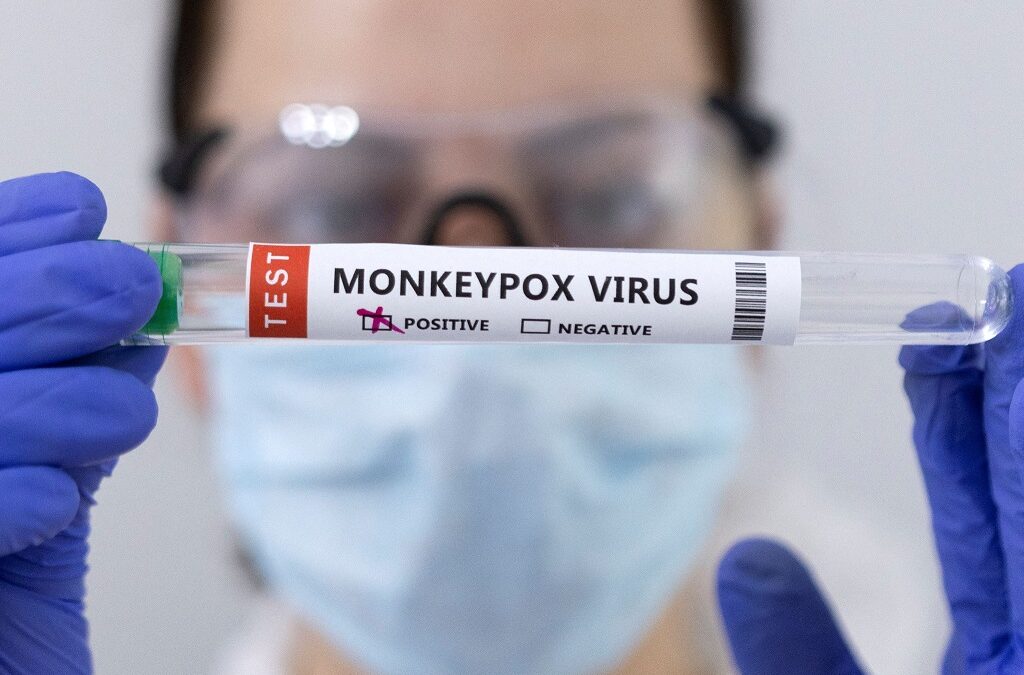 Monkeypox: EUA admitem alargar vacinação a homens com VIH