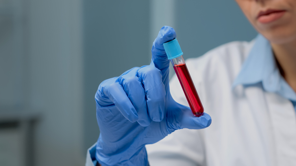 Terapia celular inovadora para o tratamento do cancro do sangue apresentada no Brasil