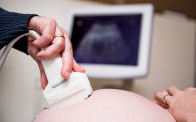 Associação Europeia de Medicina Perinatal considera muito preocupante situação da obstetrícia