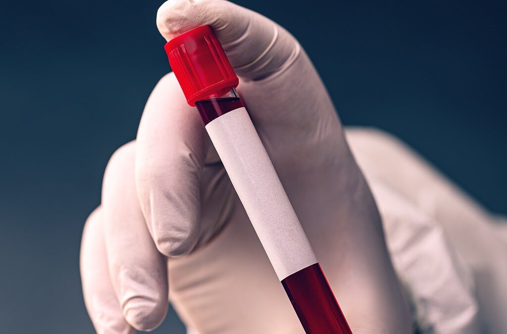 A procura de uma “biopsia líquida” capaz de diagnosticar e monitorizar o mieloma múltiplo começa a dar resultados