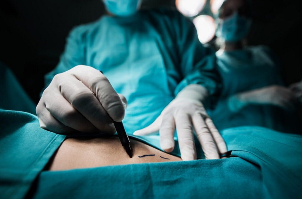 Açores reduzem lista de espera cirúrgica em 13,4% em junho para 10.027 utentes