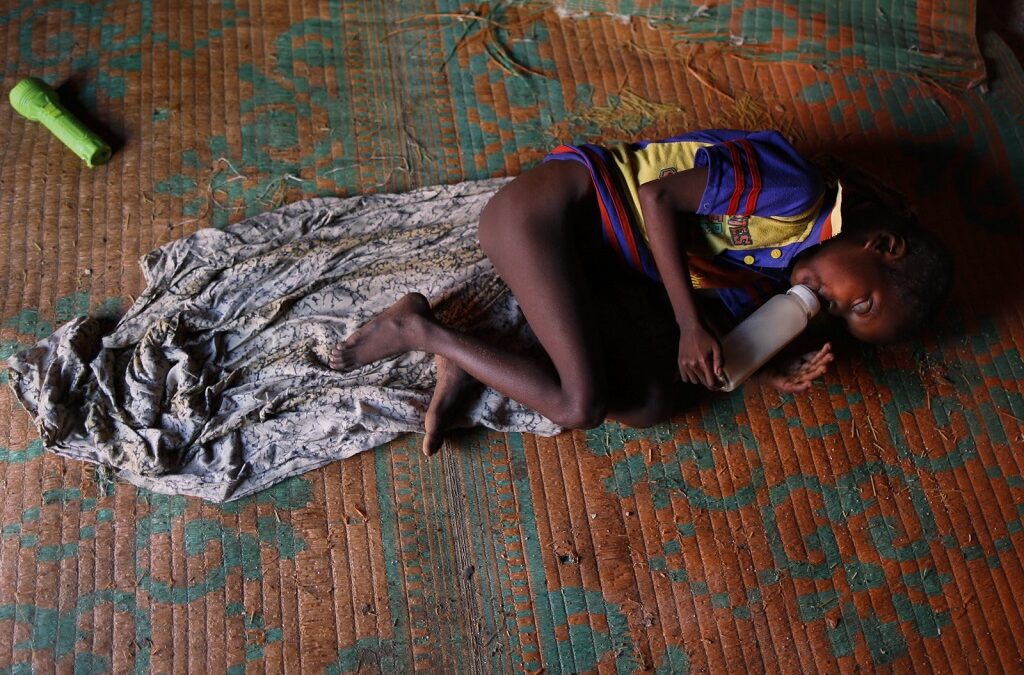 Metade das crianças com menos de 5 anos sofre de desnutrição aguda na Somália