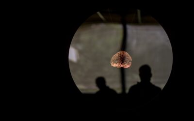 Centro Hospitalar e Universitário de Coimbra com tratamento cerebral pioneiro