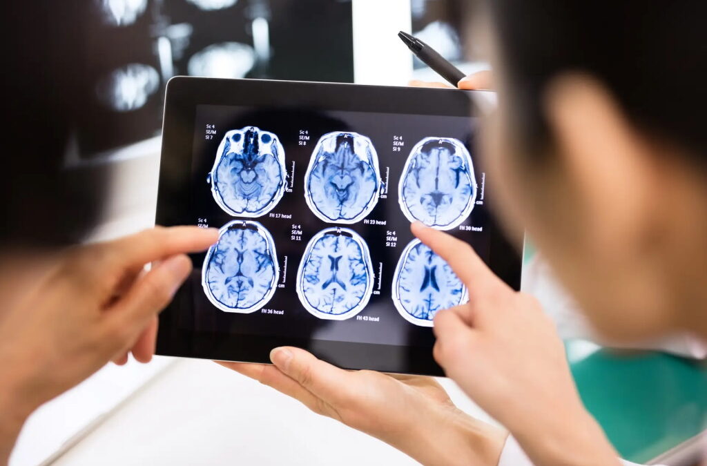 Cientistas de Coimbra estudam novas formas de tratar o traumatismo cranioencefálico