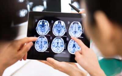 Cientistas de Coimbra estudam novas formas de tratar o traumatismo cranioencefálico
