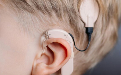 Estudo afirma que cirurgia de implante coclear provoca alterações no equilíbrio