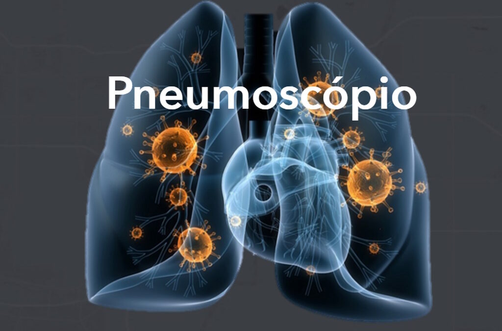 Pneumoscópio faz dois anos e alerta que “morre-se muito de pneumonia” em Portugal