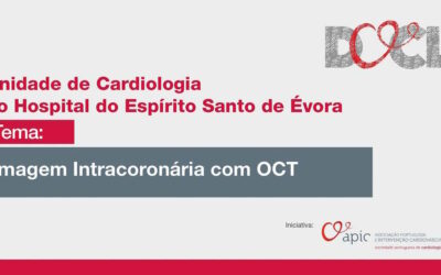 Revisão de conhecimentos sobre técnica de imagem intracoronária