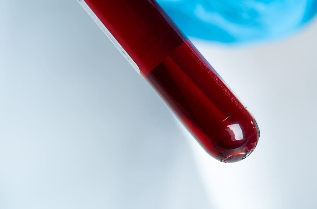Especialistas analisam novos tratamentos para doenças oncológicas do sangue