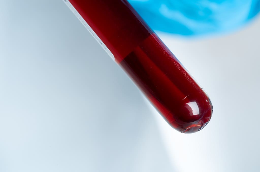 Por FabrikaPhoto_ENVATO_close-up-of-blood-test-tube-with-blood-2021-12-09-01-21-25-utc
