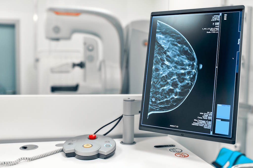 mamografia_medicine-and-health-care-2022-02-16-01-26-16-utc_Por ORION_production_envato