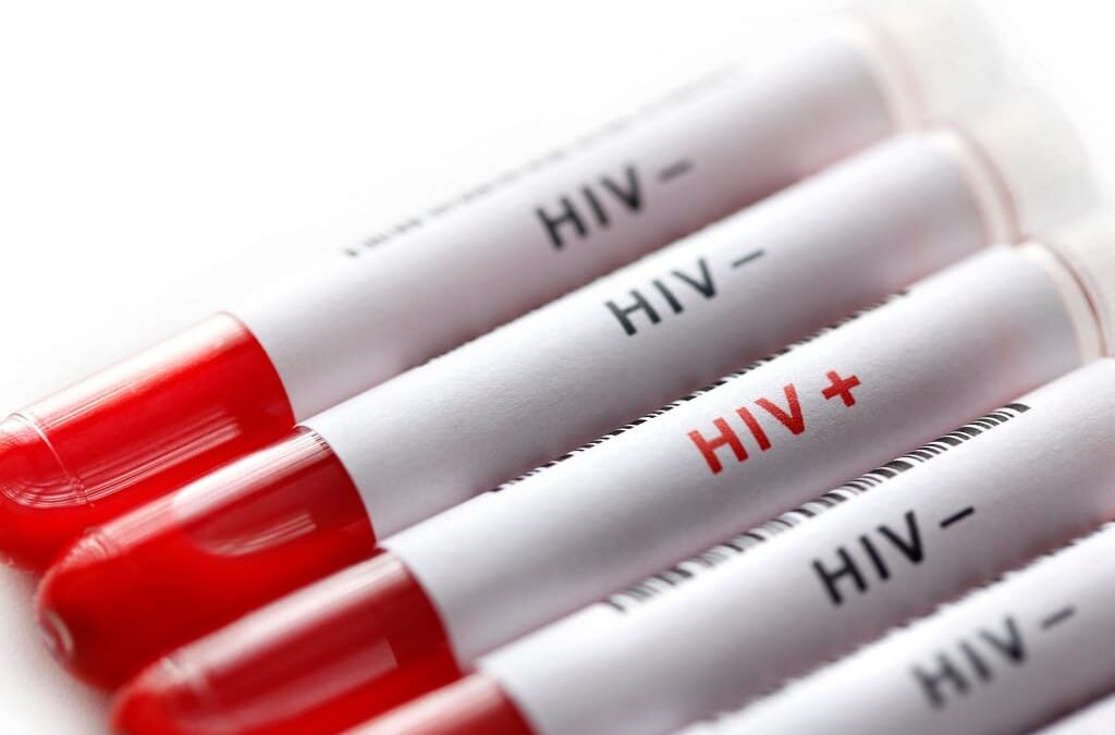 Novos avanços rumo a vacina eficaz contra o VIH graças a estratégia sequencial