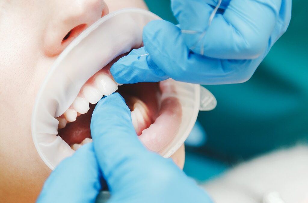 Médicos em formação vão tratar doentes graves ou sem posses que perderam dentes