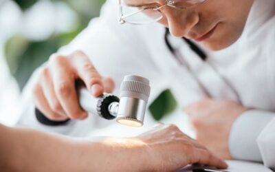 EMA aprova baricitinib para tratamento da dermatite atópica