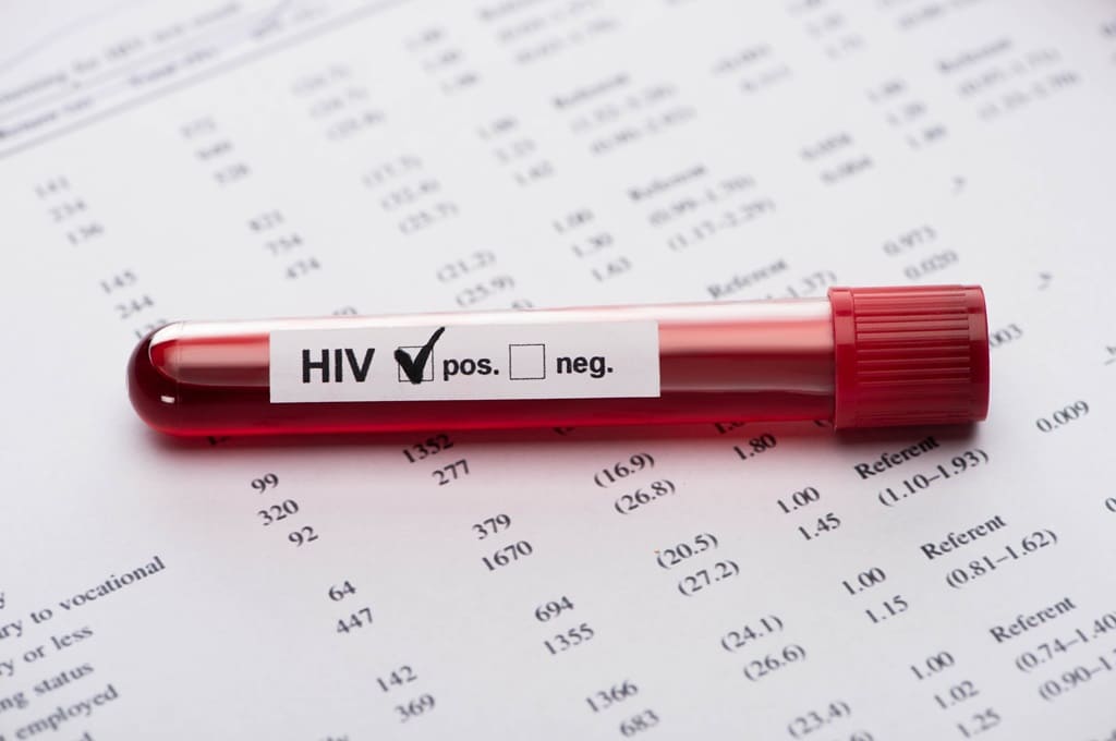 VIH_Por LightFieldStudios_ENVATO_HN_positive-hiv-blood-sample-test-on-paper-result-for-2023-11-27-04-59-54-utc