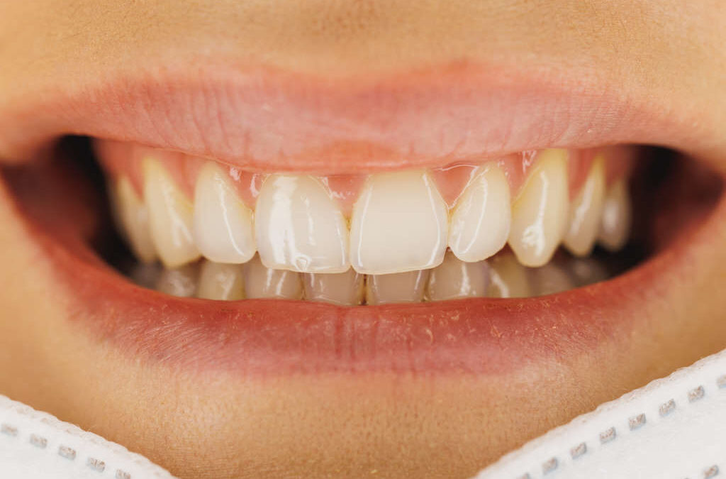Clínica dentária em Lisboa devolve sorrisos à população carenciada com consultas gratuitas