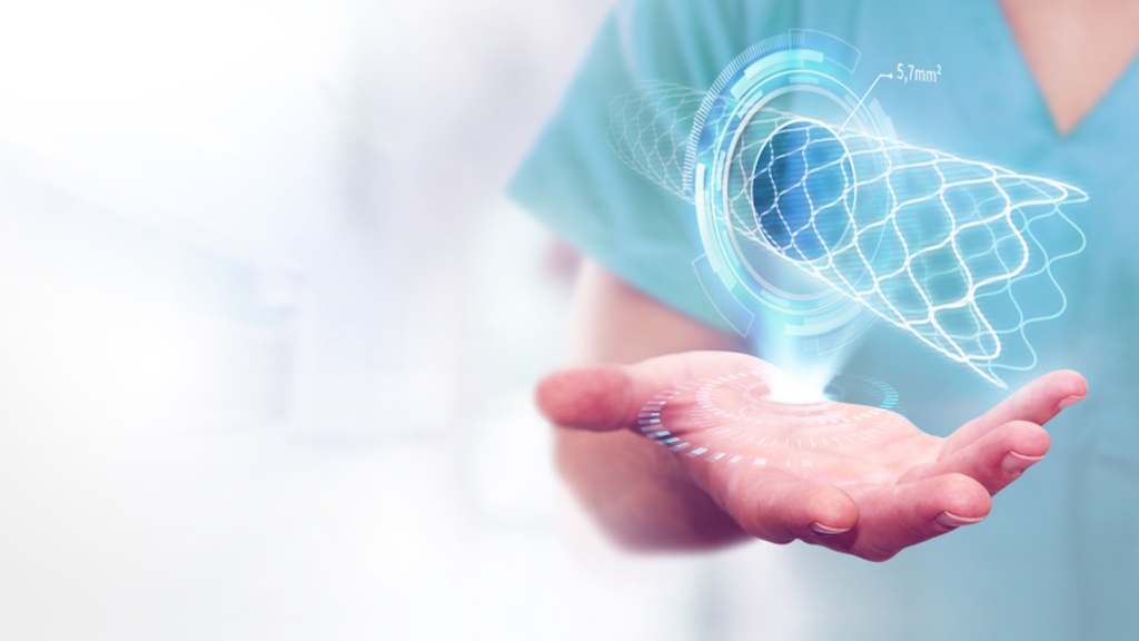 GE HealthCare apresenta tecnologia revolucionária para visualização 3S de stents coronários