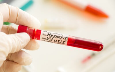 Aumenta o número de testes de diagnóstico de Hepatite B e C em 2023